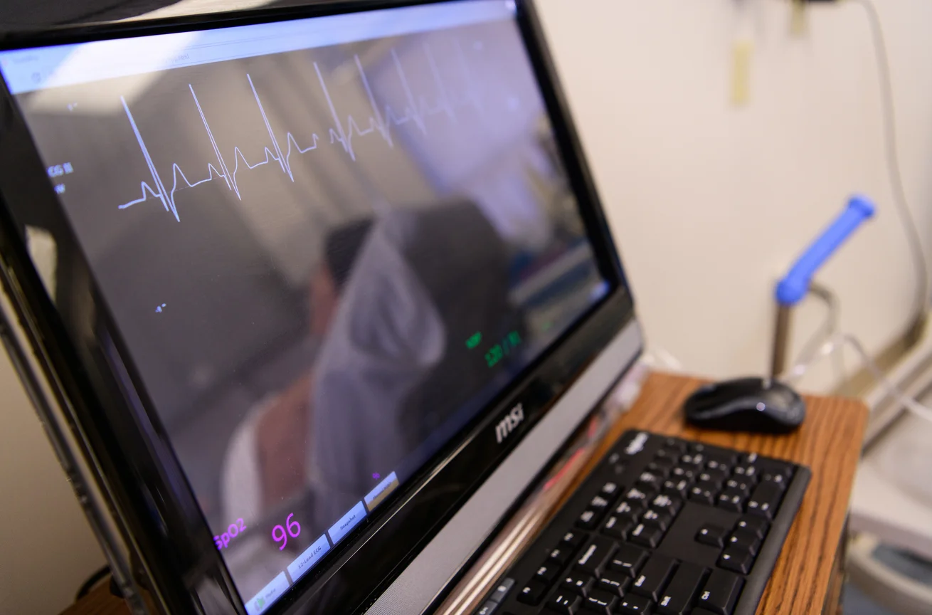 EKG Monitor